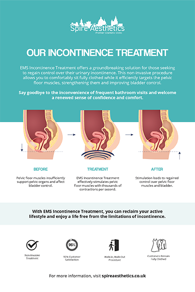 image of how urge incontinence Allesley treatment works